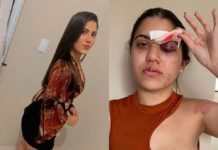 Homem que tentou matar ex-namorada em Boa Viagem é denunciado pelo MPCE