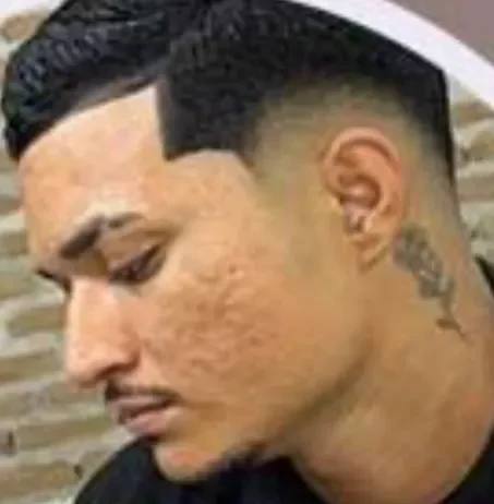 Homicídio em Ipueiras: menor mata jovem, rouba moto e se entrega em hospital de Ipu